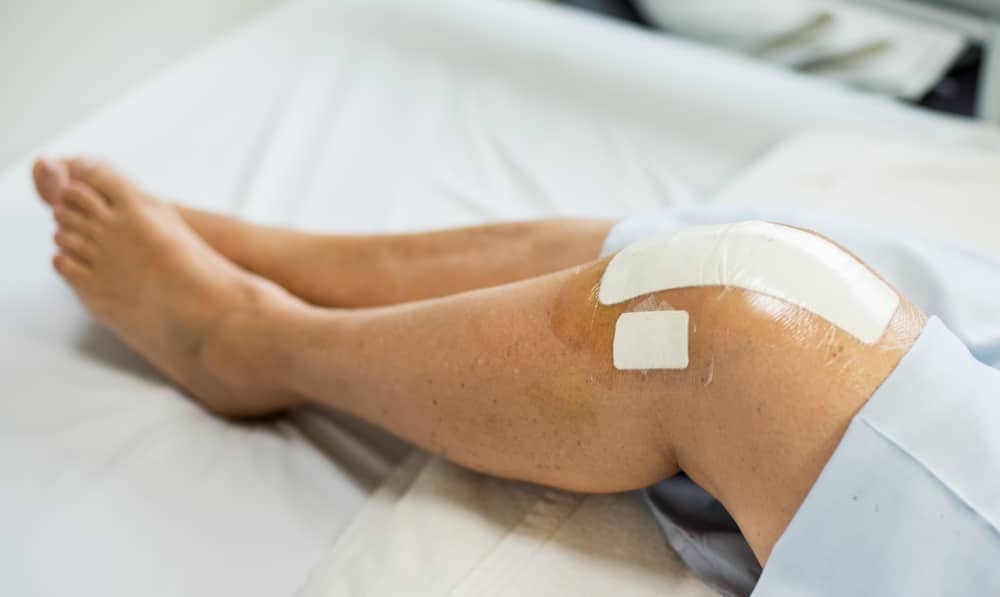 factors knee replacement recovery